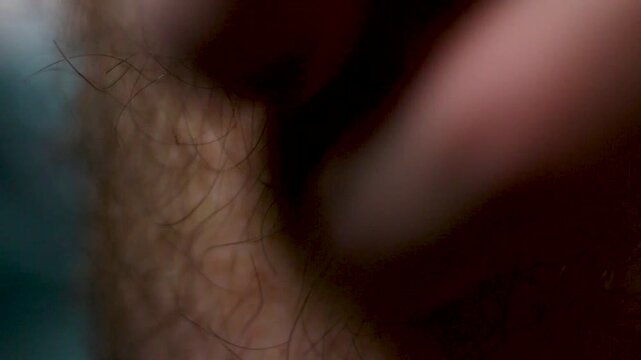 Skin irritation with redness and small bumps on hairy surface