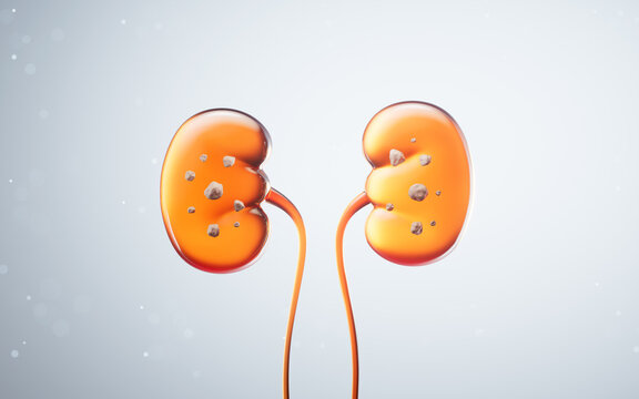 Kidney stone with biology and health care concept, 3d rendering.