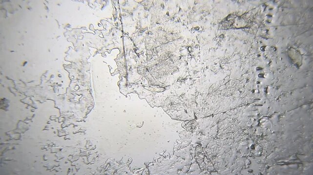 Wide view of Demodex brevis skin mite on human epidermis background under 40x brightfield microscopy