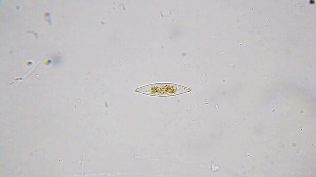 Navicula diatom microalgae with visible chloroplasts and bacteria under 1000x brightfield microscopy