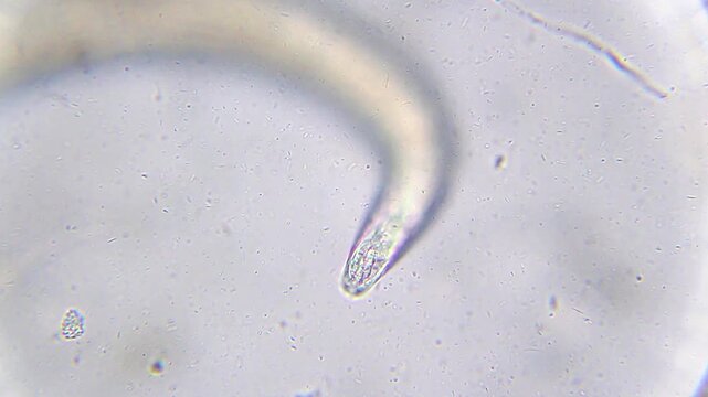 Extreme close-up of nematode roundworm anterior head section showing mouth parts under 400x brightfield microscopy