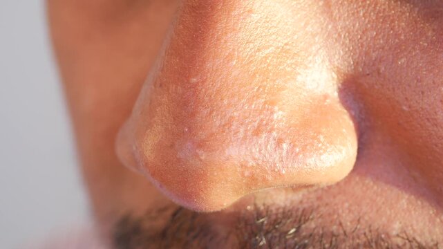 Extreme close up of male nose skin texture with pores and facial hair in outdoor sunlight