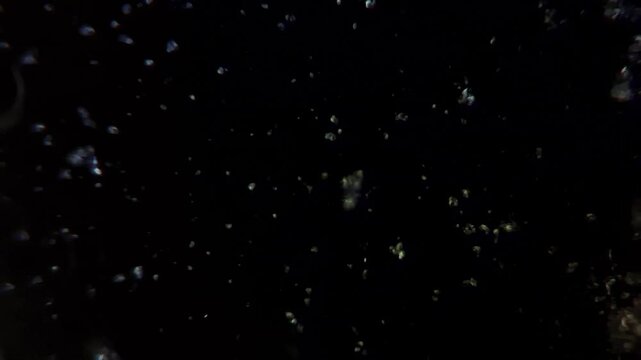 Microscopic view of Streptococcus bacteria under high magnification in darkfield illumination