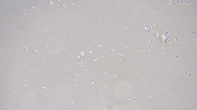 Microscopic view of Streptococcus bacteria under high magnification in  brightfield illumination