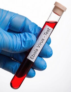 Gloved hand holds test tube with red liquid labeled ebola virus test