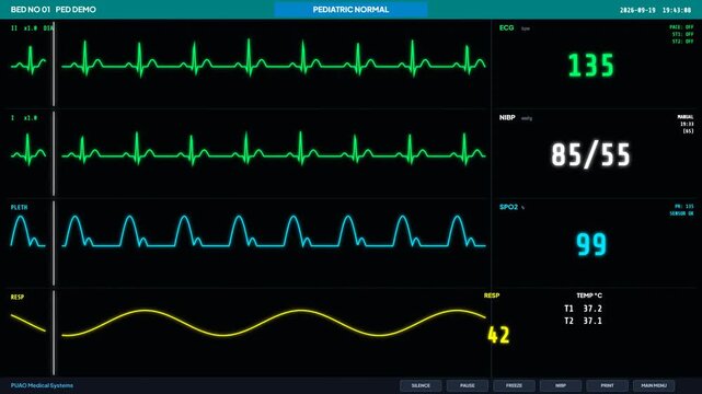 Pediatric patient monitor showing normal vital signs. Animated child ECG screen. Medical UI telemetry overlay. Children hospital display. Digital healthcare interface template. Dark UI screen.   