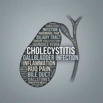 Gallbladder Inflammation And Cholecystitis Medical Word Cloud Art