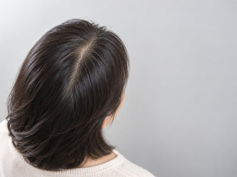 グレー背景で斜め後ろから見た40代女性の分け目と地肌