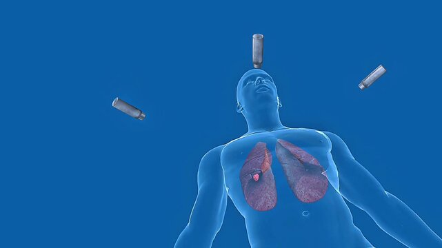 Medical illustration of radiotherapy targeting a cancerous tumor with precise ionizing radiation beams.