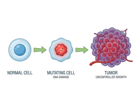 Medical illustration of tumor development from normal to mutating