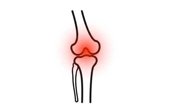 Knee joint pain highlighted in digital medical animation clip showing glowing red inflammation on human anatomy