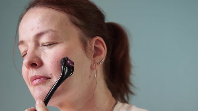 A woman using a derma roller microneedle roller on her face for skincare, concept of beauty treatment, concept of cosmetology, concept of anti-aging skincare