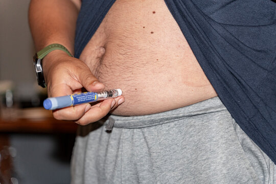 Abdominal self-injection using insulin pen for diabetes management