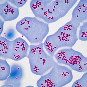 Highly  light microscopy image of platelets showing prominent granules
