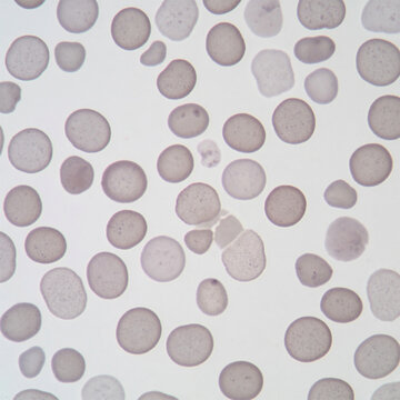 light microscopy photograph of hypogranular platelets in a blood smear

