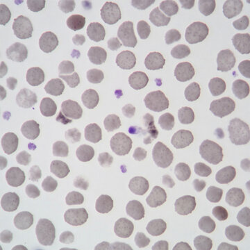 light microscopy photograph of hypogranular platelets in a blood smear


