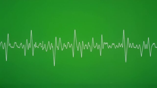 Oscilloscope trace moving on a screen