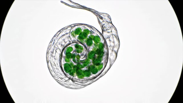 Microscopic view of an amoeba-like organism with green internal algae