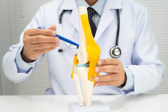 Osteoarthritis of the knee, Doctor holding human knee joint orthopedic anatomy model in hospital.