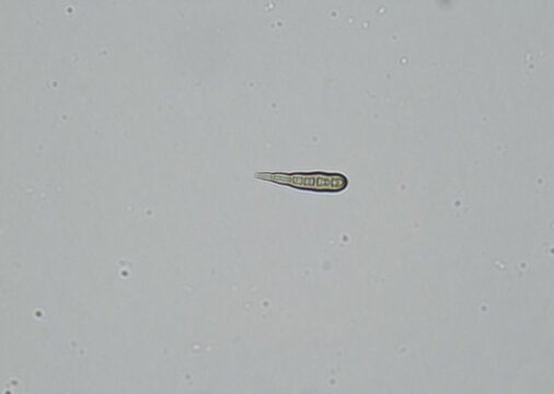 soil microorganisms under a microscope including amoeba, flagellates, nematodes, fungi, bacteria	