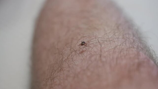 Close up macro shoot of a small tick crawling on hairy human skin, illustrating parasite exposure and potential tick bite risk.