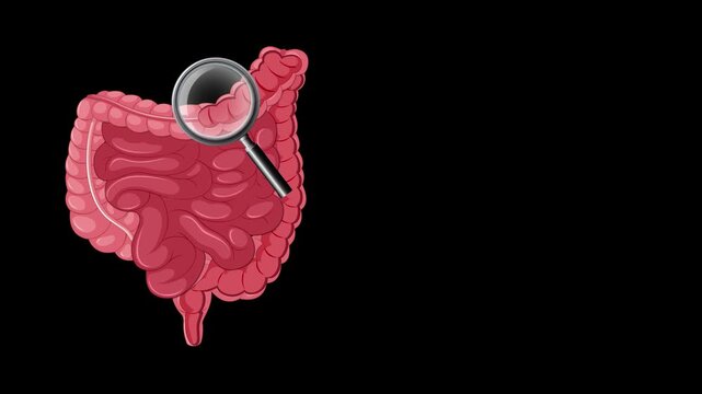 Medical animation showing colonoscopy procedure to remove intestinal polyps from human digestive tract.