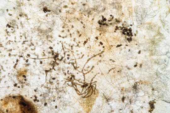 Microscopic view of fungal hyphae and conidia chains on substrate, mold contamination. Network of dark, branching hyphae mycelium intermingled with clusters of dark conidia, spores