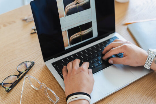 A medical professional types on a laptop displaying detailed medical eye scans at a wooden desk. Eyeglasses rest nearby in a bright clinical office setting.