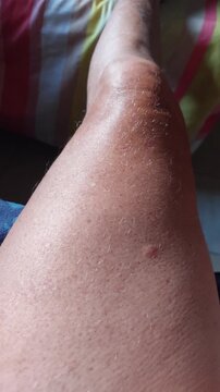 Muscle de la cuisse en mouvement