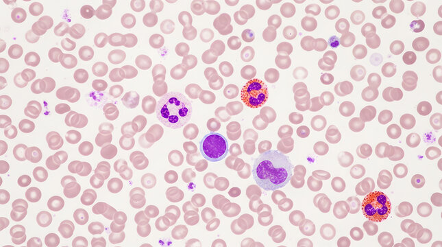 White blood cells among red blood cells under microscope