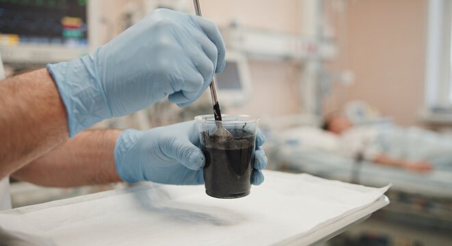 Medical worker mixing black liquid sample in plastic cup inside hospital room.