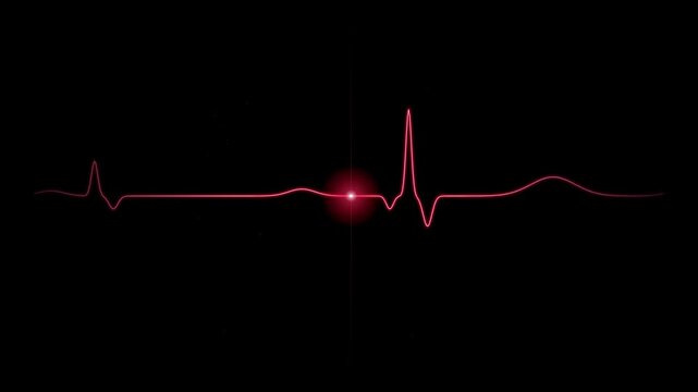 Vital EKG waveform pulsing with light against a dark background for medical concepts