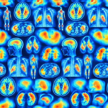 Seamless pattern of medical PET scan images showing human brain and body anatomy in blue and orange