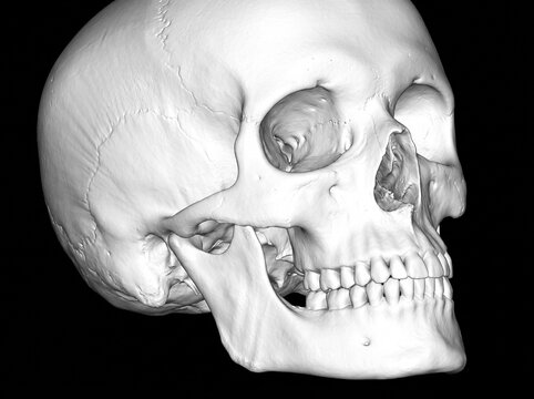 3D CT reconstruction of facial bones showing detailed skull anatomy