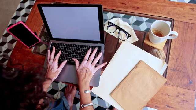 Woman with vitiligo skin typing on laptop computer at home