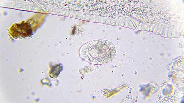 Colpoda ciliate protozoan next to a large annelid worm body under 400x brightfield microscopy