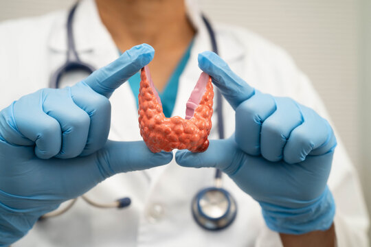 Hyperthyroidism, Overactive Thyroid, Thyroid Lymphoma, Asian doctor with thyroid gland human anatomy model in hospital.