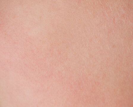 Close-up of human skin texture
