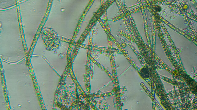 Spirogyra sp. Green Algae Under Microscopic View. Chlorophyta