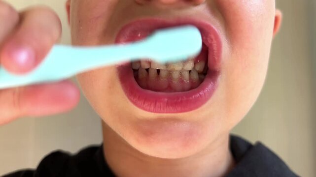 Child with primary teeth brushes front teeth with an up and down motion, showing visible enamel changes. Dental hygiene, oral care, pediatric dentistry.