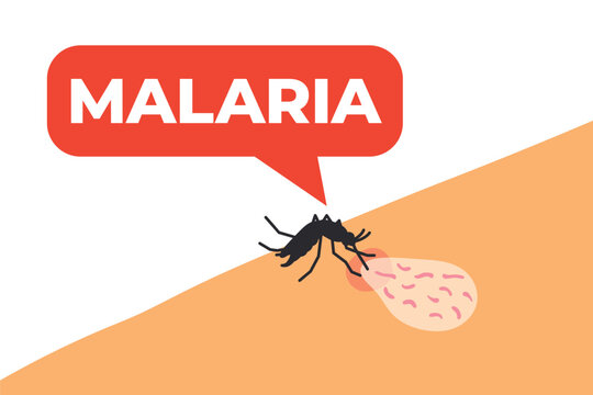 mosquito biting human skin and transmitting malaria parasites, with a speech bubble with malaria text, for medical education, disease awareness and healthcare design - vector illustration