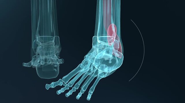 Animating 3D legs at medical studio with right foot pointing, pressing heel pad, showing tendon