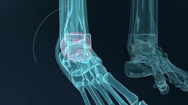 Animating x-ray ankle rotating fanning and reforming on playback in lab showing tibia talus joint