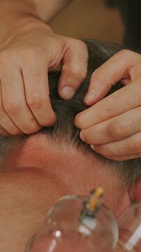 hands separating short dark hair while glass suction cup presses scalp during warm cupping therapy in clinic