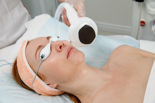 Device Based Facial Rejuvenation Treatment for Woman in Cosmetic Clinic