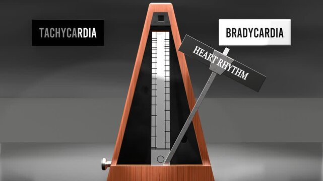 Heart rhythm cycles between tachycardia and bradycardia. Visualizing a repeated pattern of heart rhythm that swings between extremities: tachycardia and bradycardia. Made by humans for humans.