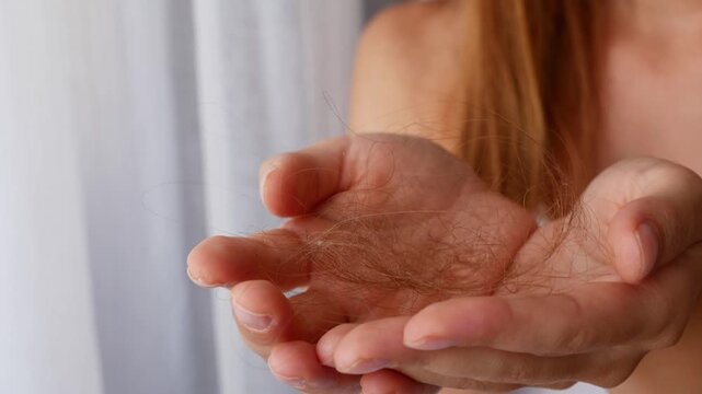 Close-up of woman holding fallen hair in hands showing hair loss and shedding problem