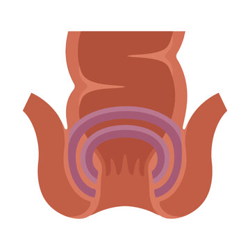 Anorectal Anatomy Diagram: Hemorrhoid Banding Procedure Illustration