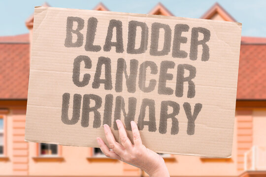"Bladder cancer urinary" Malignancy of the urine storage organ. BLADDER. URINARY. CANCER. UROTHELIAL. MALIGNANCY.