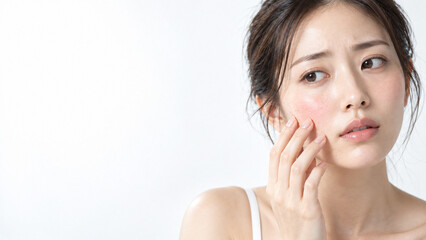 Obraz premium 赤みのある頬を気にするアジア人女性の肌悩み写真